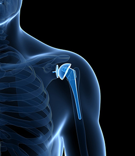 shoulder surgery services Dubai